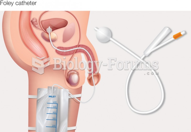 Types of catheters: Indwelling (Foley) catheter.