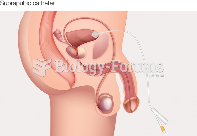 Types of catheters: Suprapubic catheter.