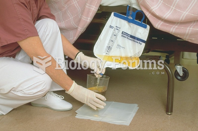 The medical assistant is measuring the urine output from a patient who has an indwelling Foley ...