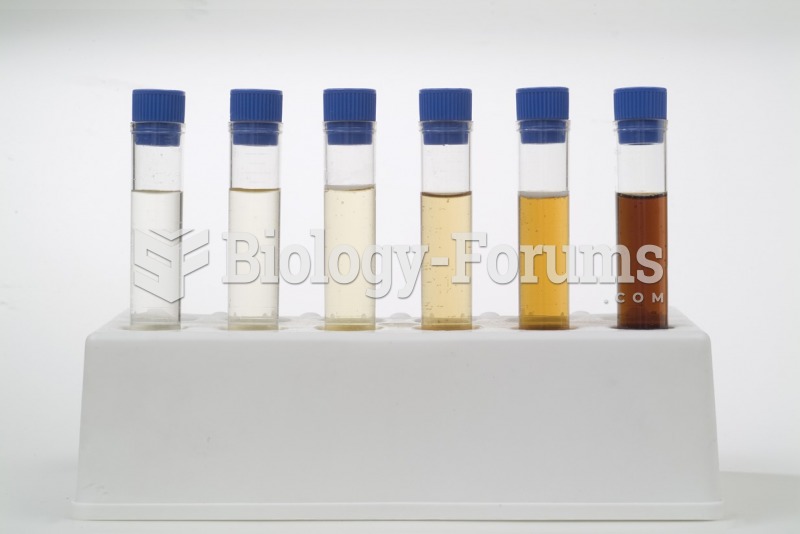 Evaluating the Physical Characteristics of Urine