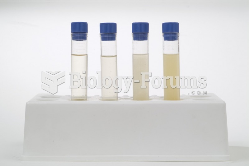 Evaluating the Physical Characteristics of Urine 