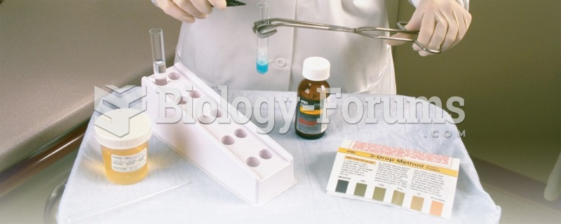 Testing for Glucose in Urine Using the Tablet Method