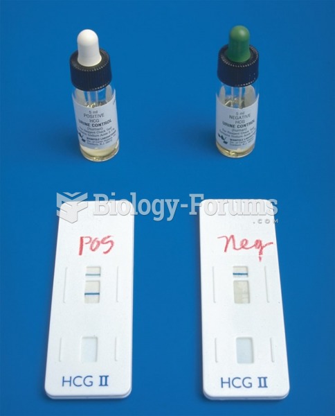 Performing a Urine Pregnancy Test Using the Enzyme Immunoassay Method