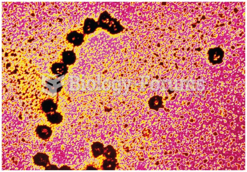 Colorized election micrograph of a polyribosome.