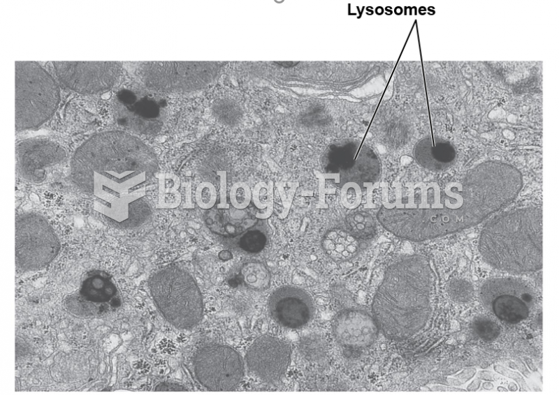 Electron micrograph of lysosomes.