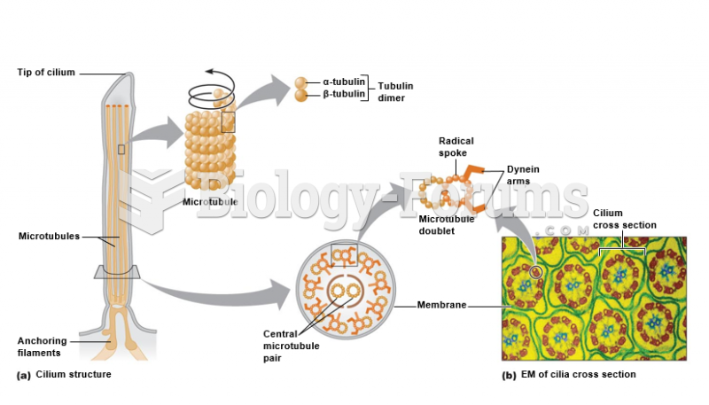 Microtubules.