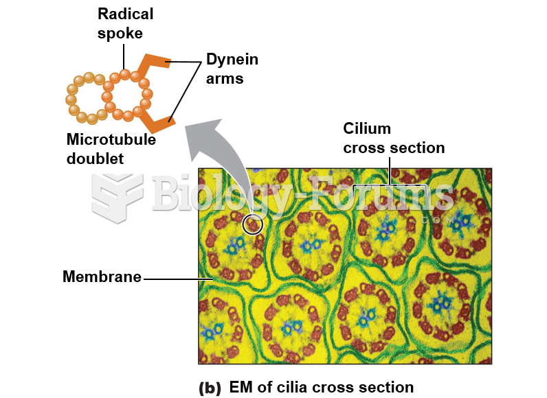 Microtubules: EM of cilia cross section