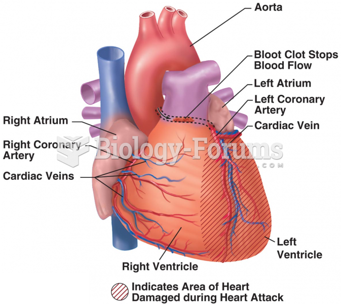Coronary Artery Blockage