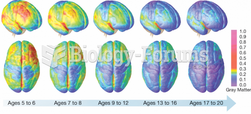 Gray Matter Development over the Surface of the Cortex  