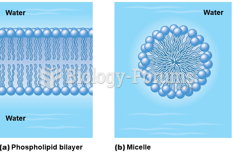 Structures formed by phospholipids in an aqueous environment.