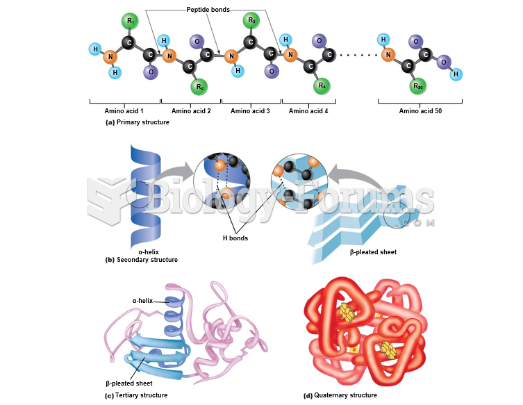 Levels of protein structure.