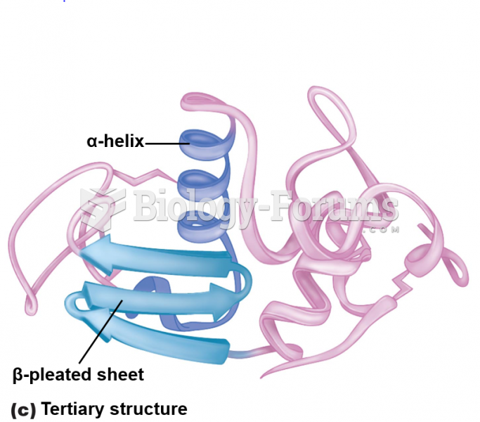 Levels of protein structure: Tertiary structure