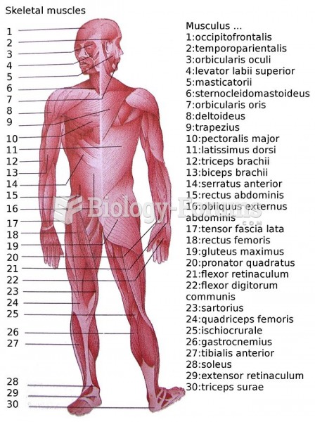 A schematic showing some of the skeletal muscles of a Homo sapiens.