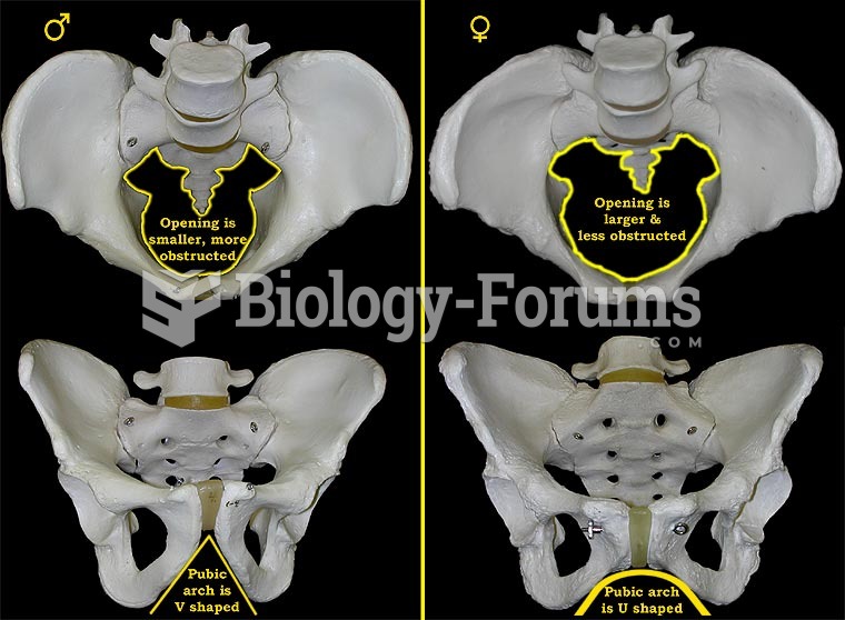 Pelvis of male versus female