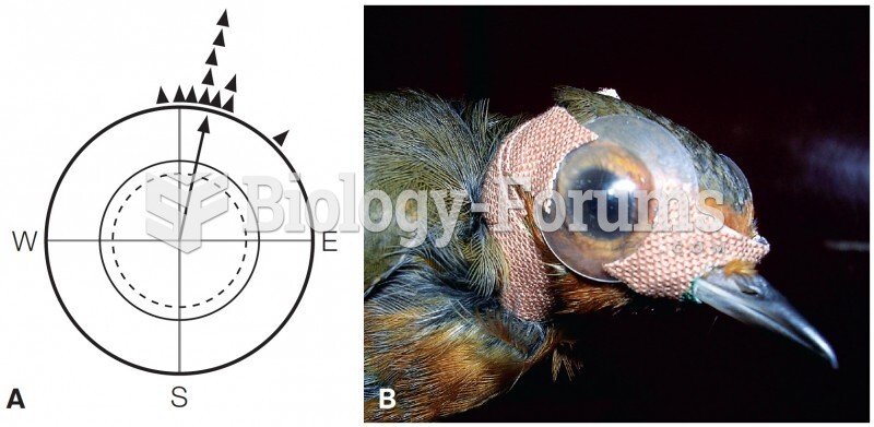 Vision-based Magnetic Compass in European Robins