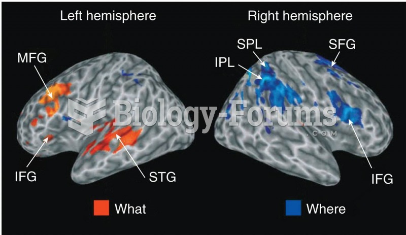 “Where” versus “What”