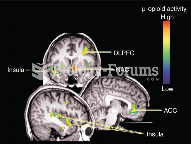 Effects of a Placebo on μ-Opioid Neurotransmission 