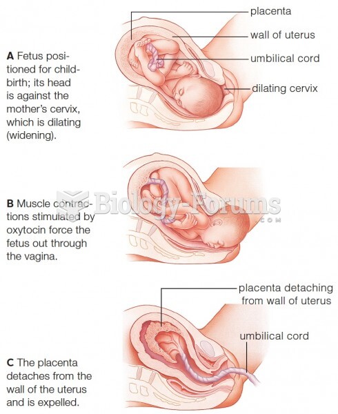 Expulsion of fetus and afterbirth during normal delivery. The afterbirth consists of the placenta, t