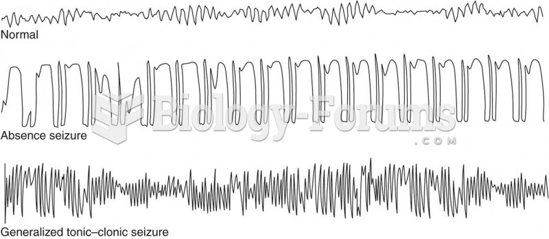 EEG recordings showing the differences between normal, absence seizure, and generalized tonic–clonic