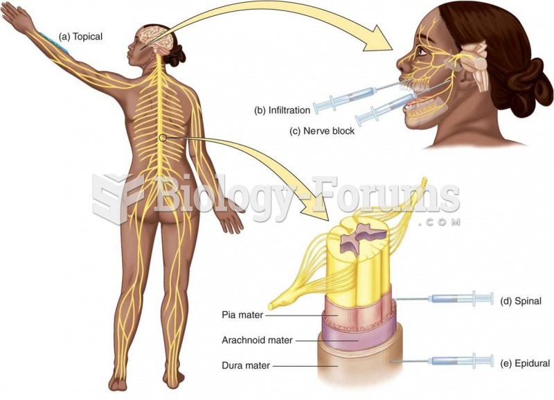 Techniques for applying local anesthesia: (a) topical; (b) infiltration; (c) nerve block; (d) spinal