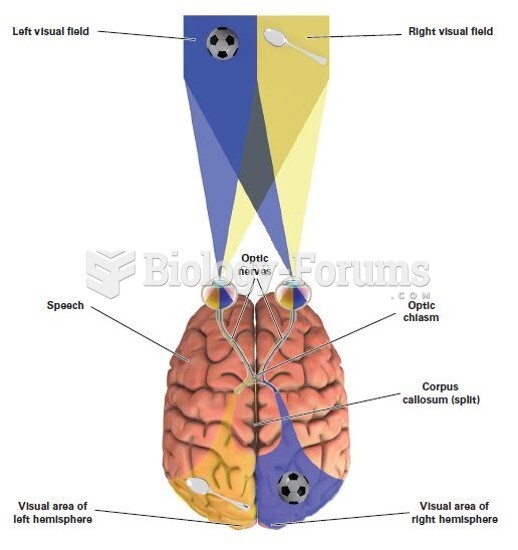 Right and Left Visual Fields