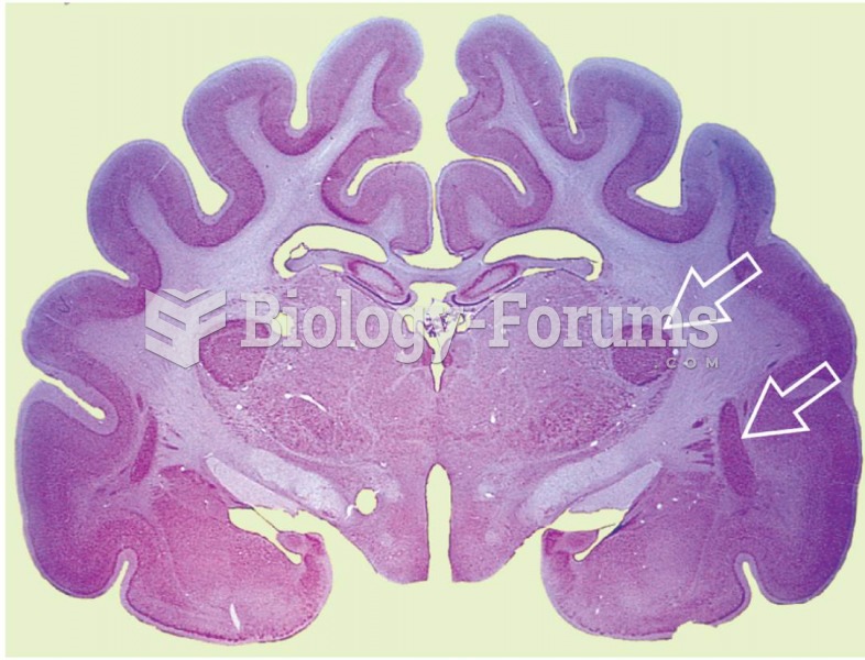 Frontal Section of a Cat Brain 
