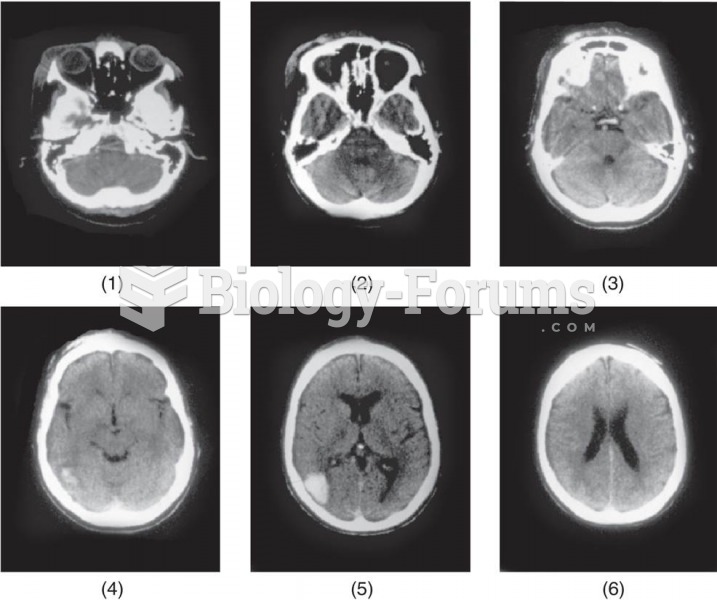 CT Brain Scans 