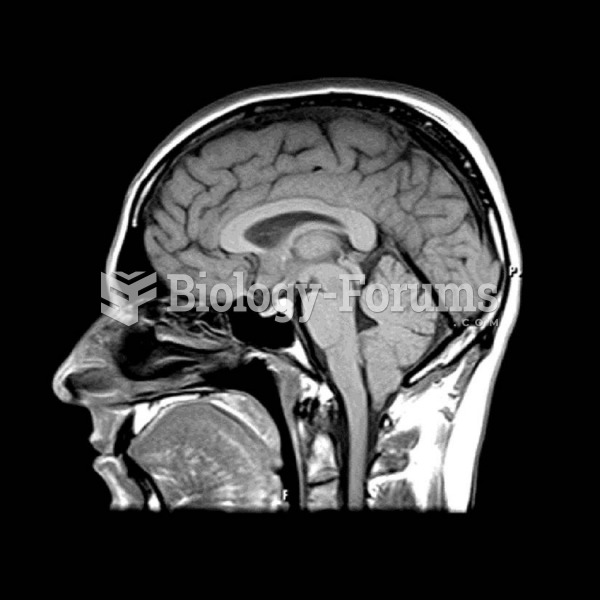 Midsagittal MRI Scan of a Human Brain 