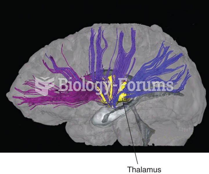 Diffusion Tensor Imaging