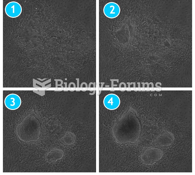 Time-course of reprogramming mouse fibroblasts into induced pluripotent stem cells