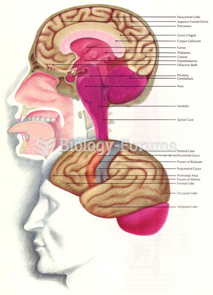 Lateral View of the human brain in cross section