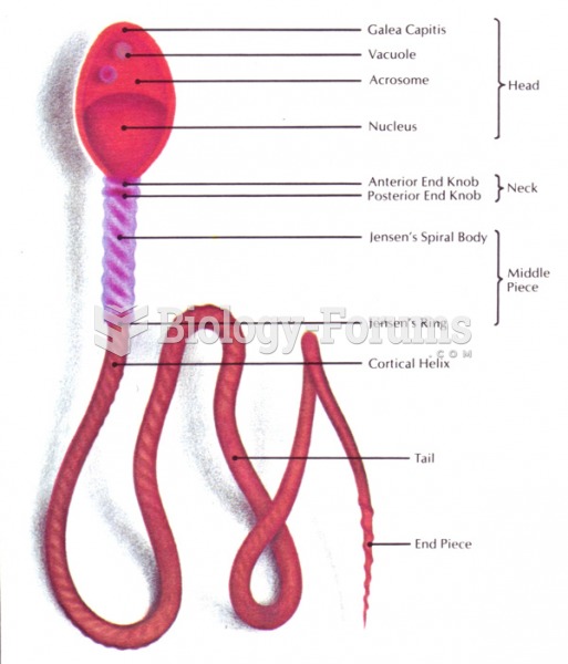 Human Sperm greatly enlarged