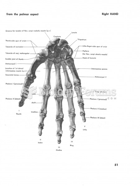 Right Hand from the Palmar Aspect