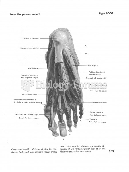 Right foot from the plantar aspect