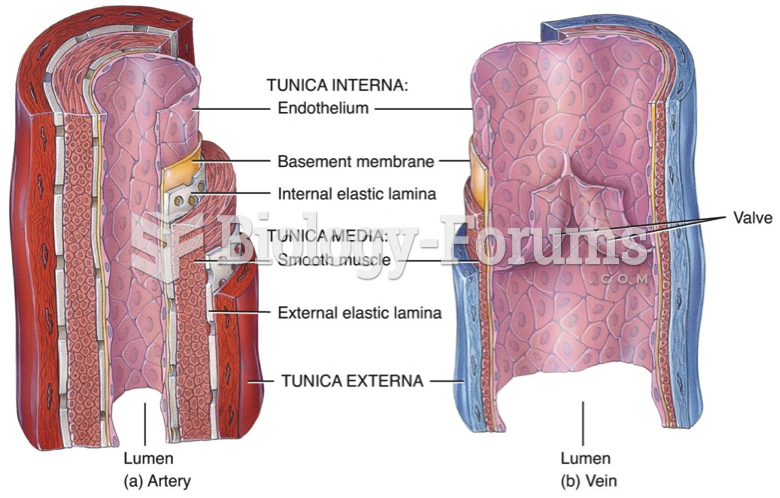 Artery and Vein (structure)