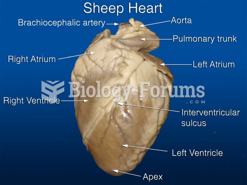 ANTERIOR SHEEP HEART