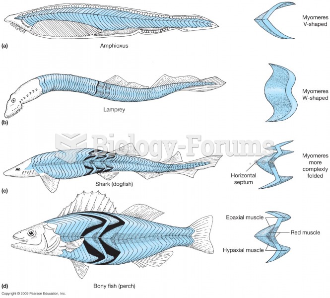 Lamprey versus Fish