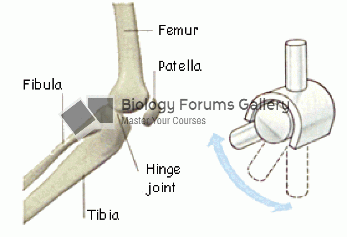 Hinge joint