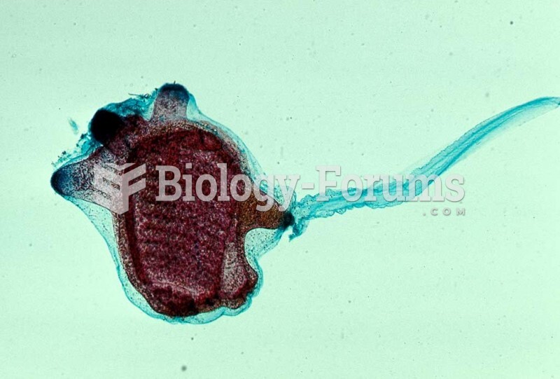 Tunicate larva (Ascidia), early metamorphosis. LM. 