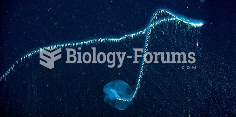 Deep Pelagic Zone: Giant siphonophore