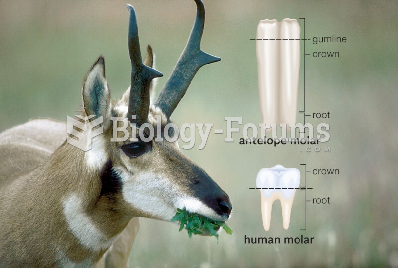 Dietary adaptations of an antelope, a ruminant. 