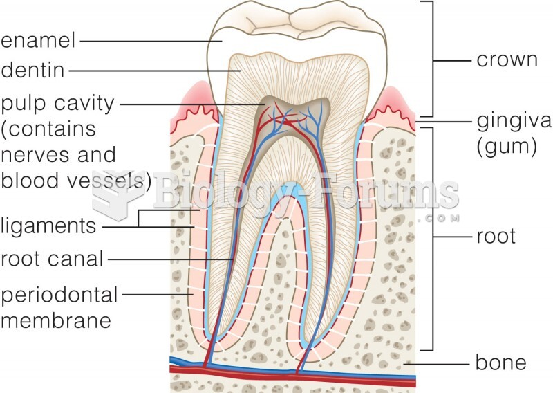 Cross-section of a human molar