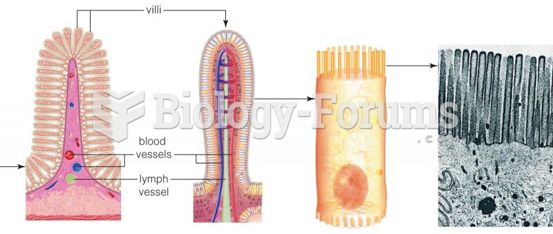 Structure of the small intestine. 