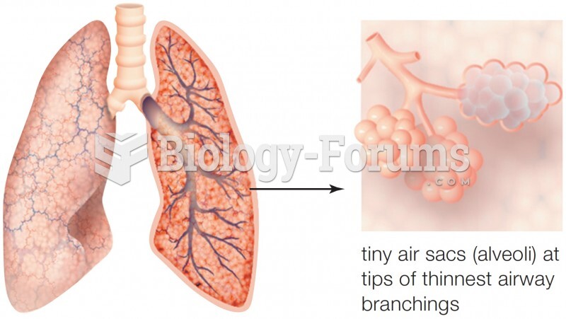 Mammalian lungs