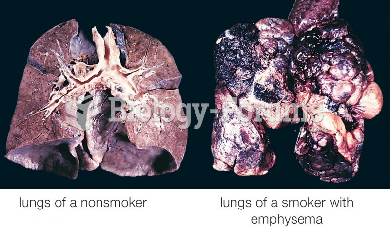 Smoking’s effect on lungs