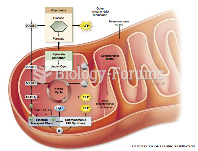 Overview of Aerobic Respiration