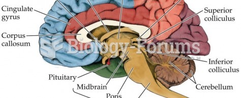 Image of Brain Structures