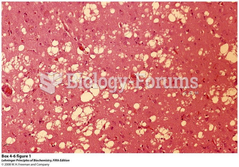 Stained section of cerebral cortex from autopsy of a patient with Creutzfeldt-Jakob disease