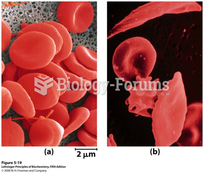 A comparison of (a) uniform, cup-shaped, normal erythrocytes