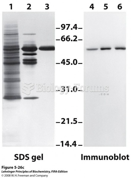 An immunoblot. Lanes 1 to 3 are from an SDS gel; samples from successive stages